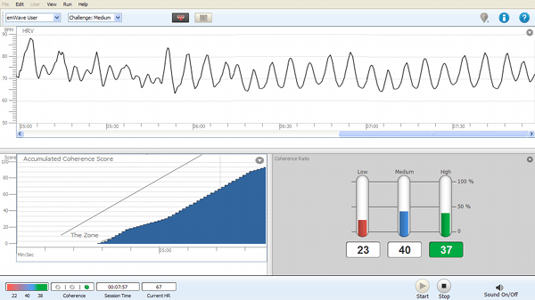 Heart Rate Variability Measurement and Outcomes